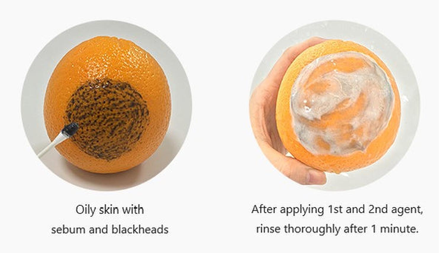 Pack Adiós Manchas1- Exfoliante AHAs + Máscara Oxígeno 2 minutos Amplen